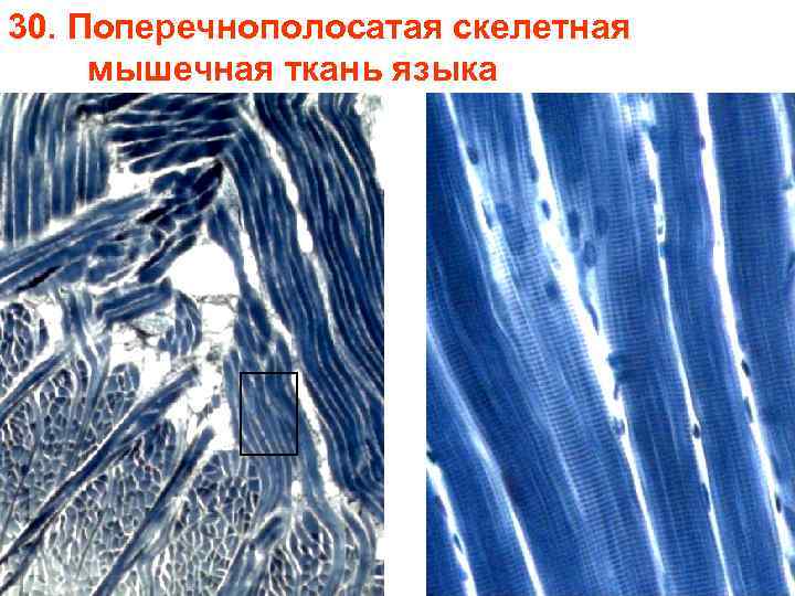 30. Поперечнополосатая скелетная мышечная ткань языка 