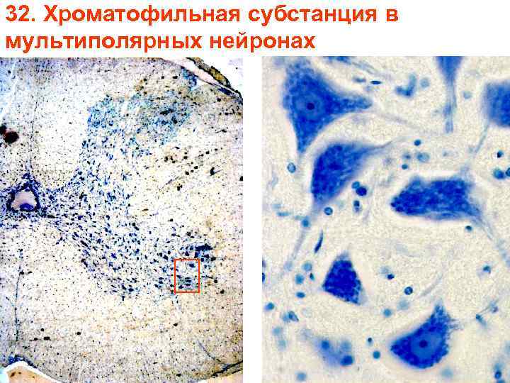 32. Хроматофильная субстанция в мультиполярных нейронах 