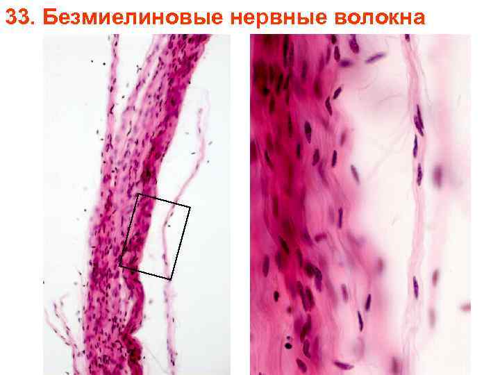 33. Безмиелиновые нервные волокна 