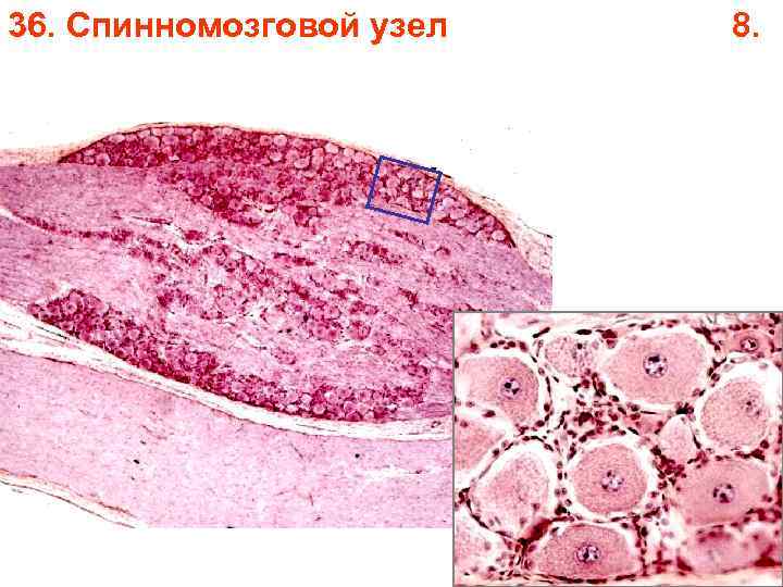 36. Спинномозговой узел 8. 