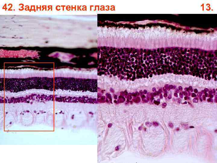 42. Задняя стенка глаза 13. 