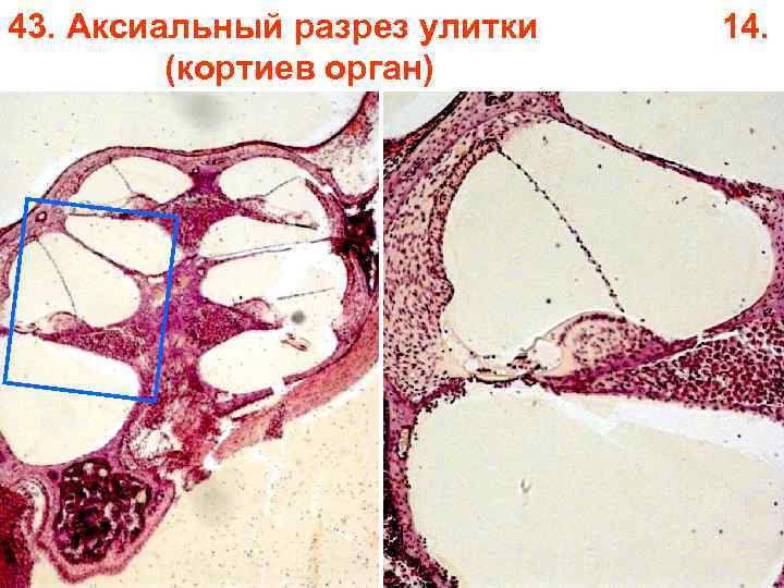 43. Аксиальный разрез улитки (кортиев орган) 14. 