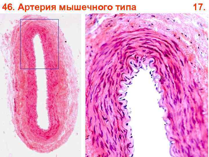 46. Артерия мышечного типа 17. 