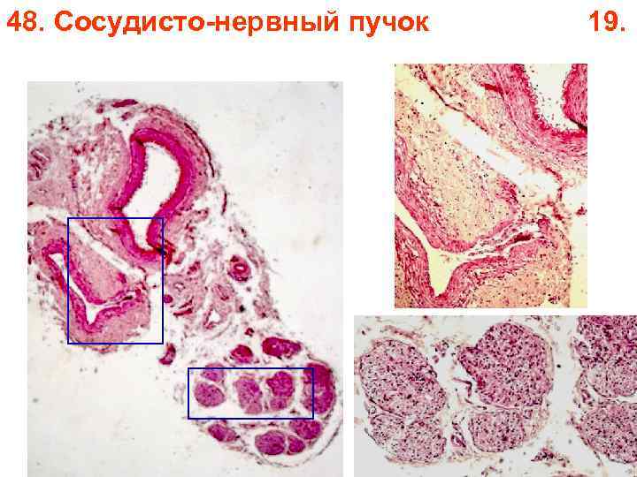 48. Сосудисто-нервный пучок 19. 