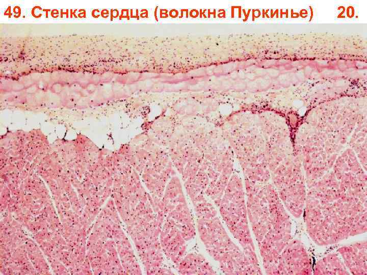 49. Стенка сердца (волокна Пуркинье) 20. 