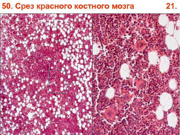 50. Срез красного костного мозга 21. 