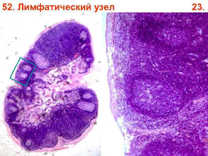 52. Лимфатический узел 23. 