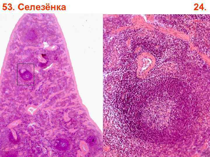 53. Селезёнка 24. 