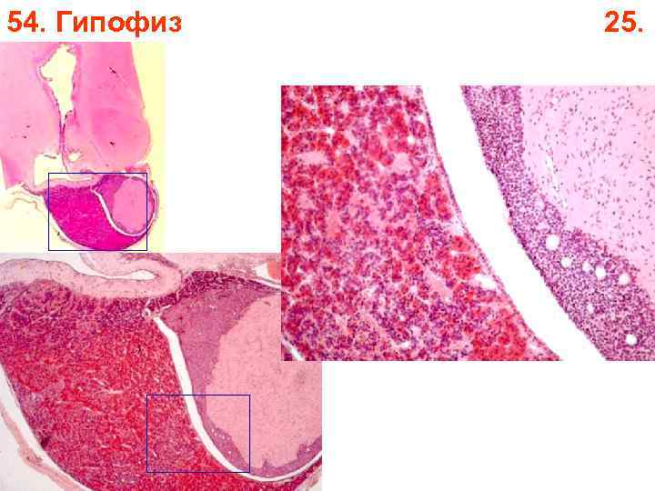 54. Гипофиз 25. 