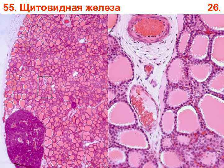 55. Щитовидная железа 26. 