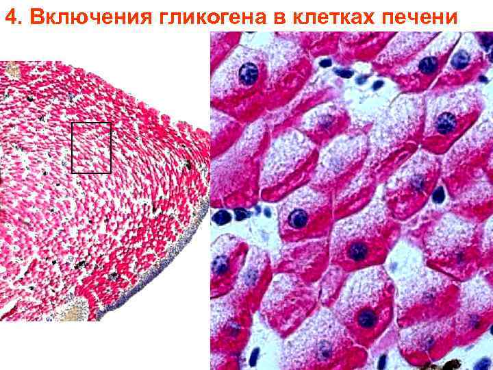 4. Включения гликогена в клетках печени 