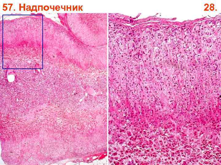 57. Надпочечник 28. 