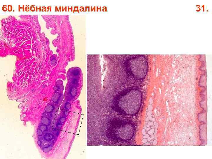 60. Нёбная миндалина 31. 