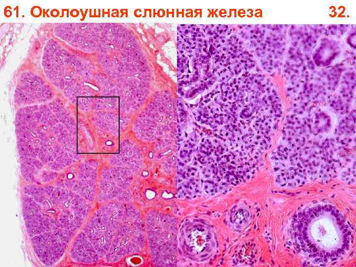 61. Околоушная слюнная железа 32. 