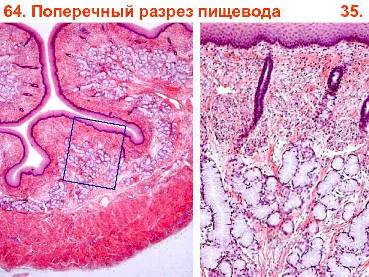 64. Поперечный разрез пищевода 35. 