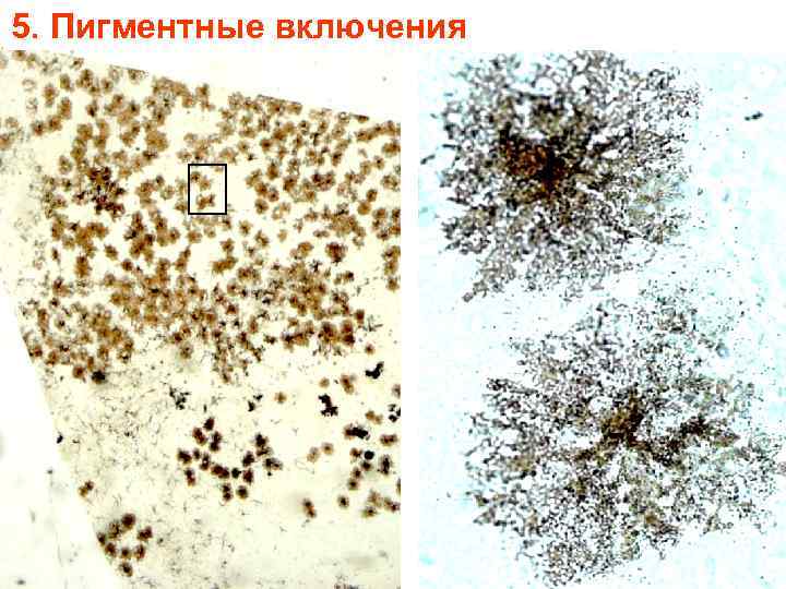 5. Пигментные включения 