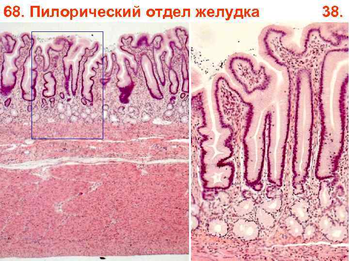 68. Пилорический отдел желудка 38. 