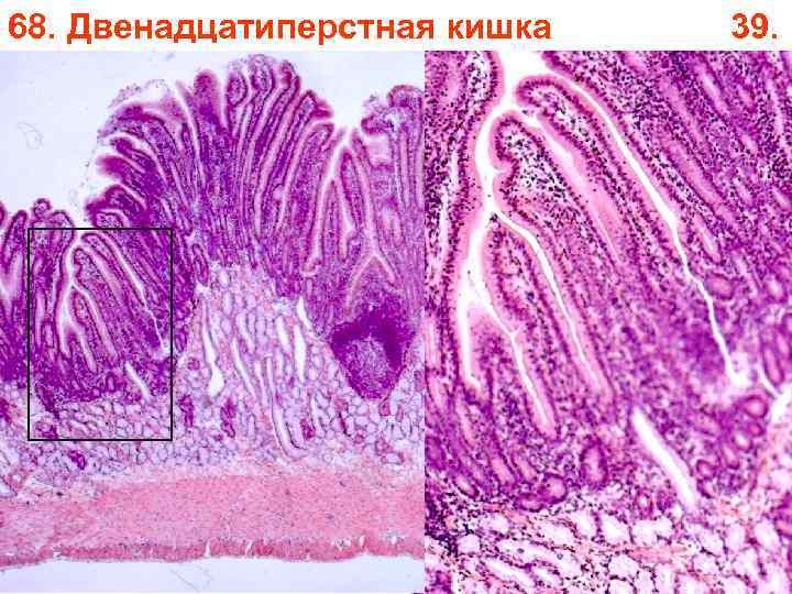 68. Двенадцатиперстная кишка 39. 