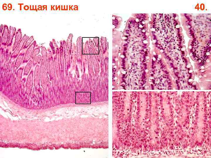 69. Тощая кишка 40. 