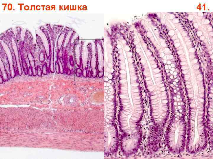 70. Толстая кишка 41. 