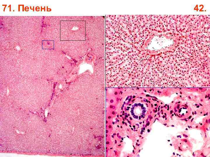 71. Печень 42. 