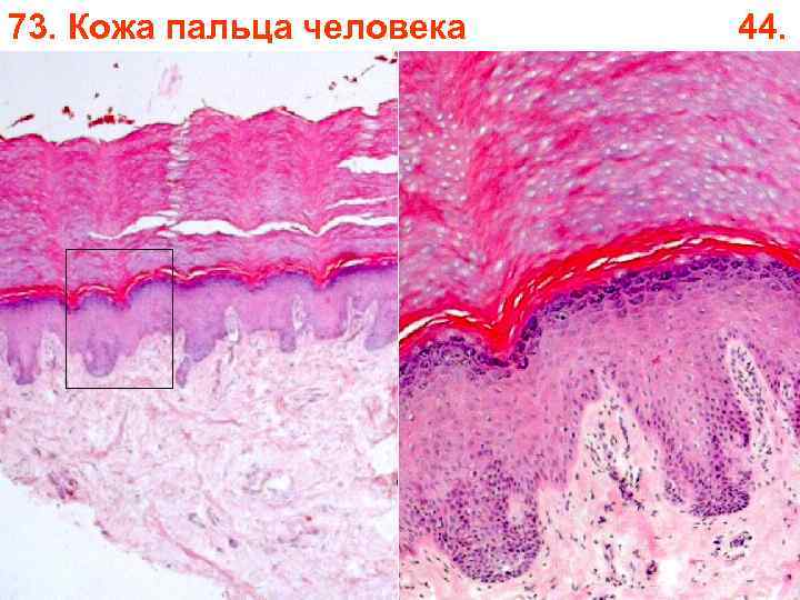 73. Кожа пальца человека 44. 