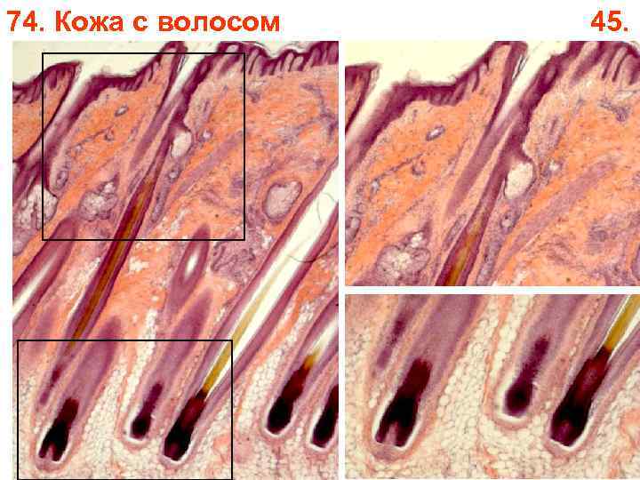 74. Кожа с волосом 45. 