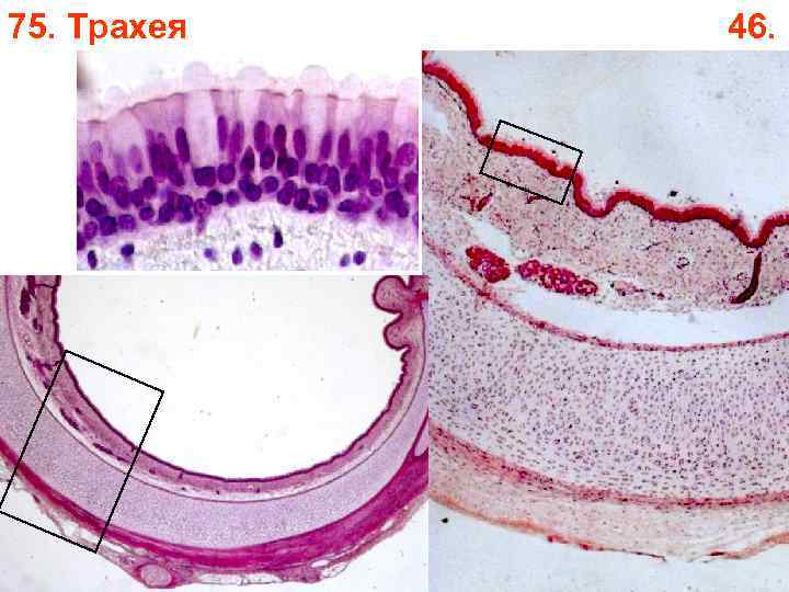 75. Трахея 46. 