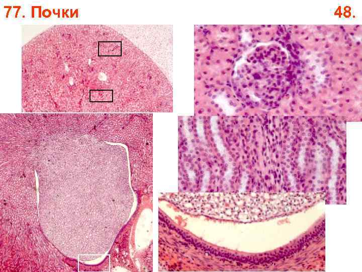 77. Почки 48. 