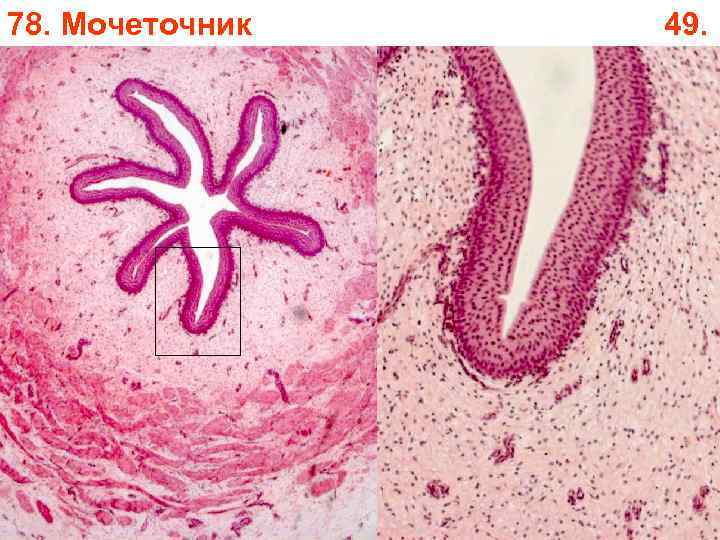 78. Мочеточник 49. 