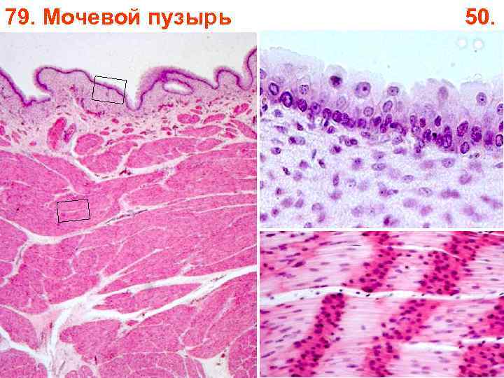 79. Мочевой пузырь 50. 
