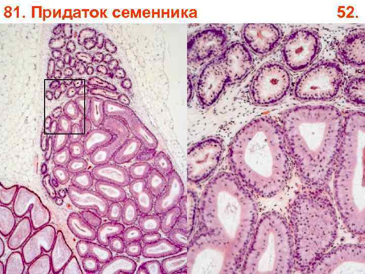 81. Придаток семенника 52. 