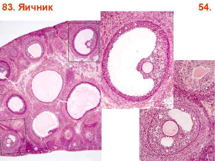 83. Яичник 54. 