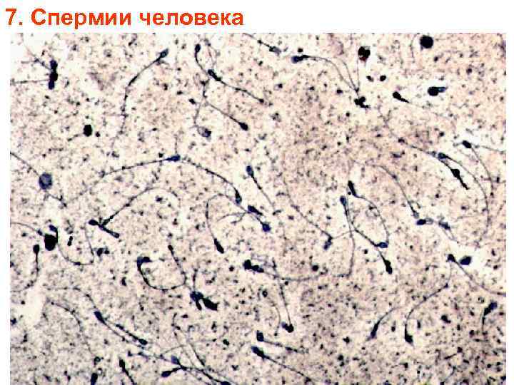 7. Спермии человека 