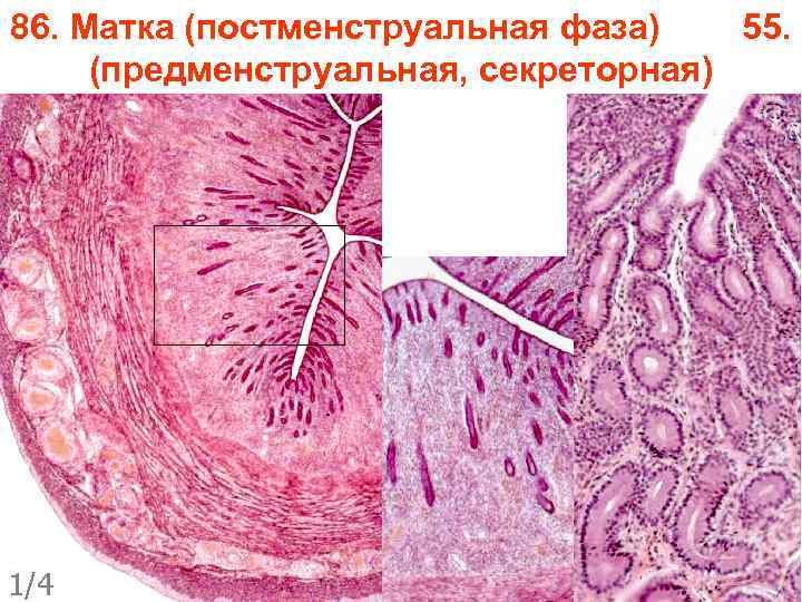 86. Матка (постменструальная фаза) 55. (предменструальная, секреторная) 1/4 