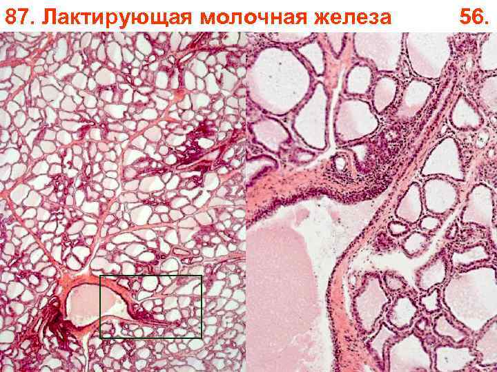 87. Лактирующая молочная железа 56. 