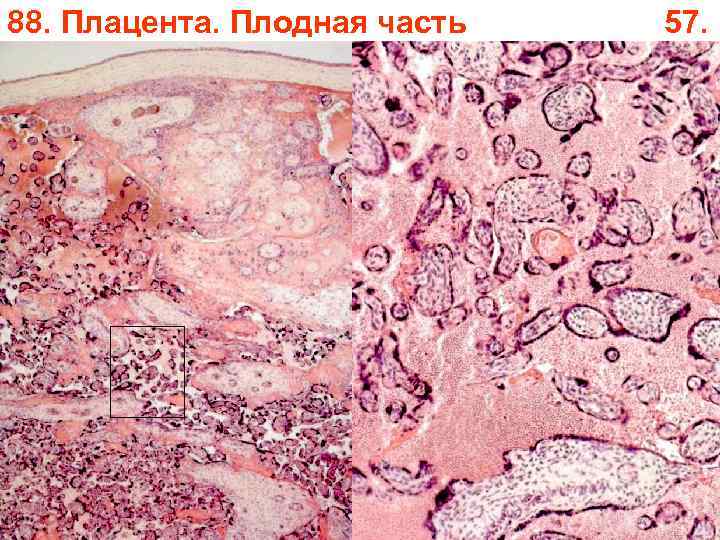 88. Плацента. Плодная часть 57. 