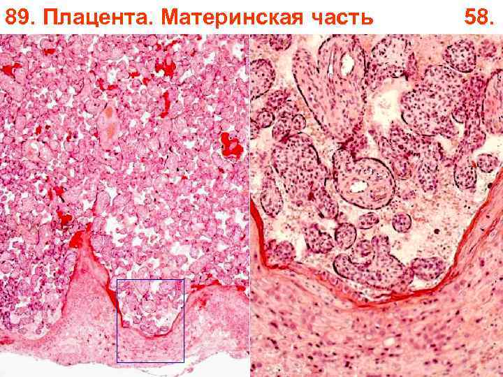 89. Плацента. Материнская часть 58. 