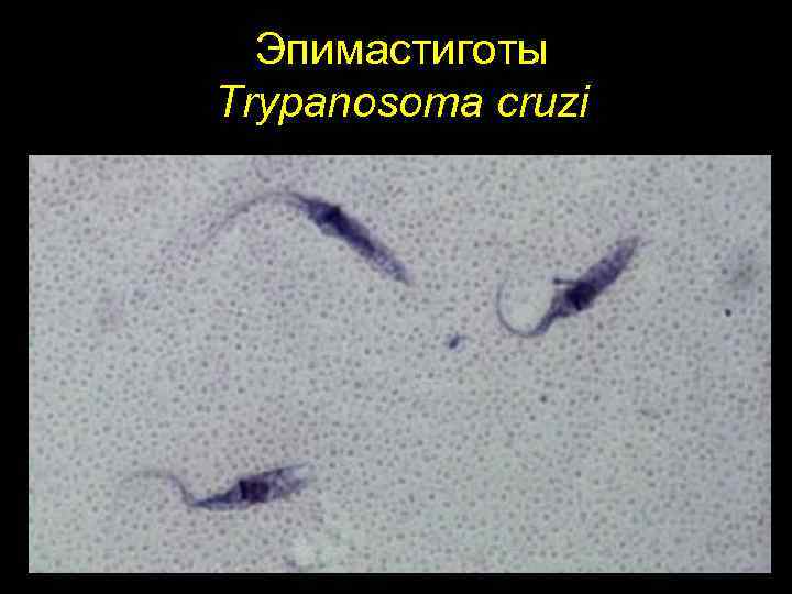 Эпимастиготы Тrypanosoma cruzi 