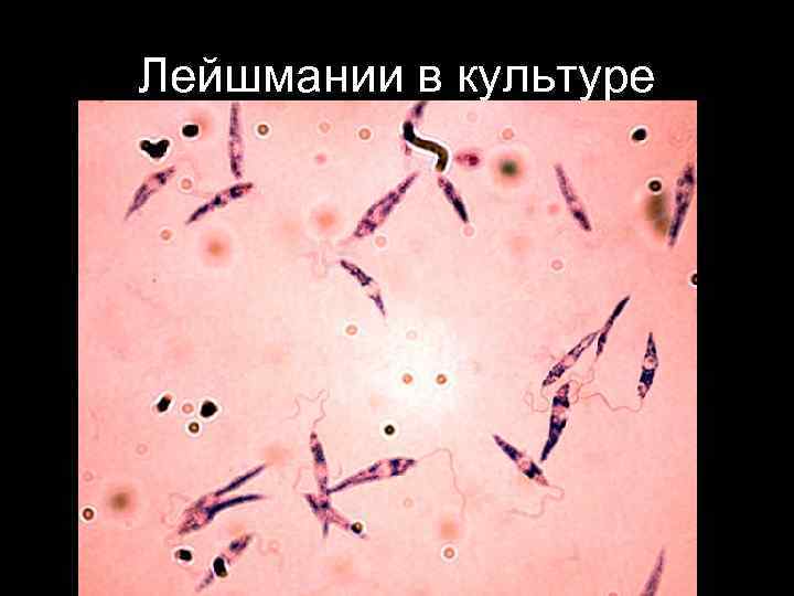 Лейшмании. Leishmania donovani возбудитель. Промастиготы лейшманий. Лейшмания кожная препарат. Лейшмания кожная под микроскопом.