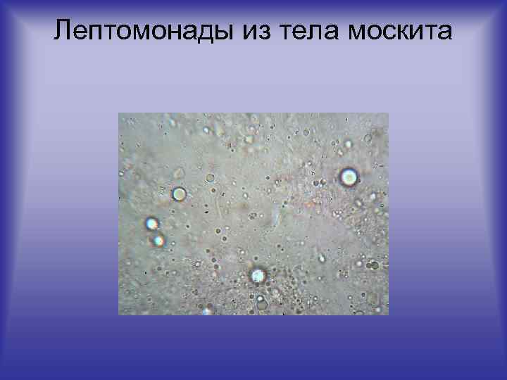 Лептомонады из тела москита 