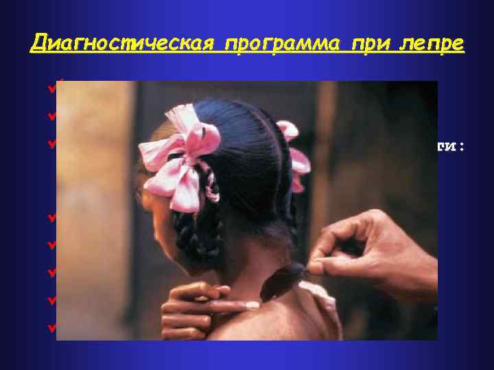 Диагностическая программа при лепре ü ü ü Анамнез (парестезии) Клинические проявления Выпадение кожной чувствительности: