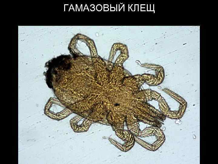 ГАМАЗОВЫЙ КЛЕЩ 