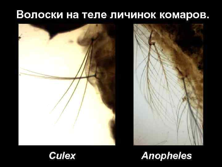 Волоски на теле личинок комаров. Culex Anopheles 