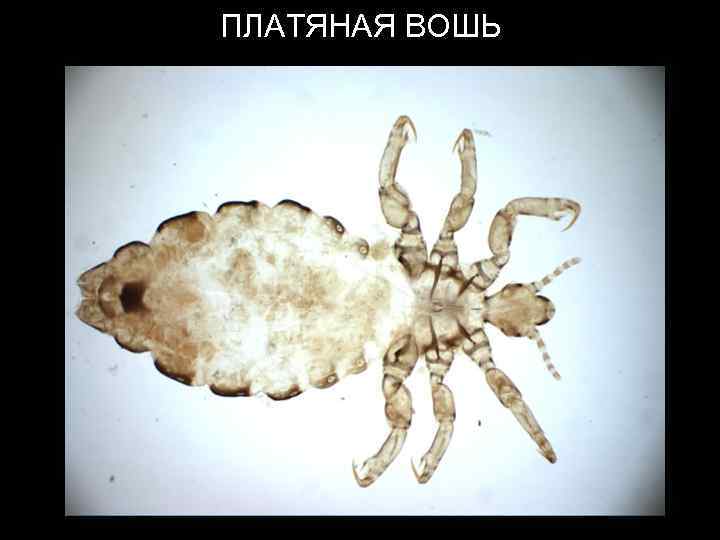 ПЛАТЯНАЯ ВОШЬ 