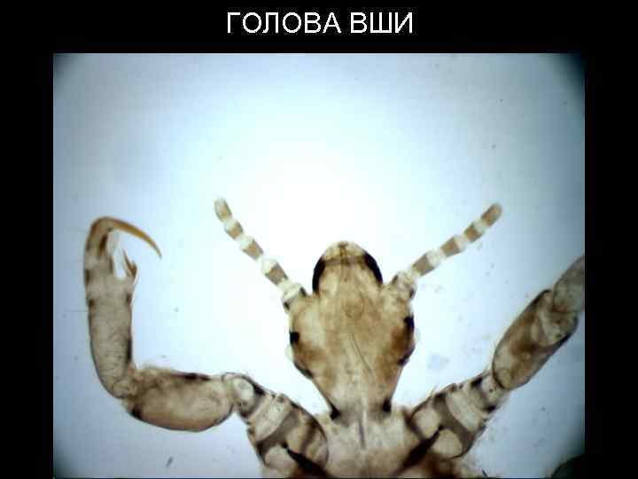 ГОЛОВА ВШИ 