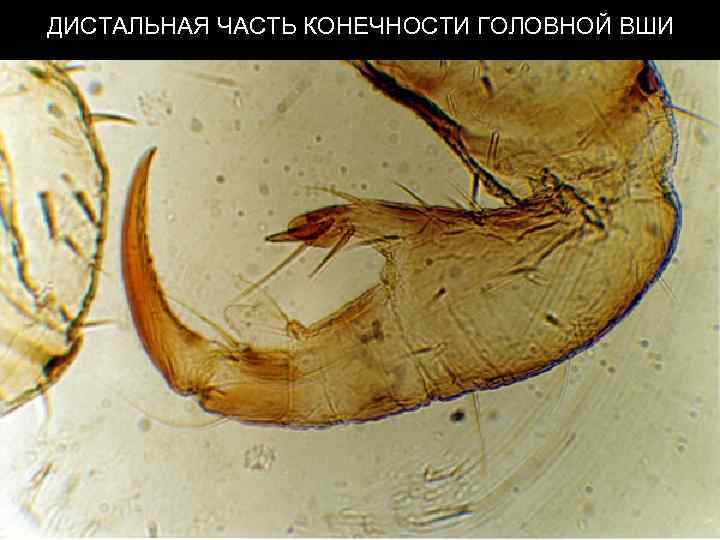 ДИСТАЛЬНАЯ ЧАСТЬ КОНЕЧНОСТИ ГОЛОВНОЙ ВШИ 