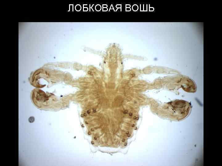 ЛОБКОВАЯ ВОШЬ 