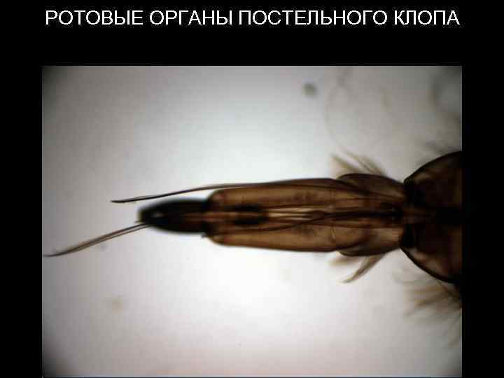 РОТОВЫЕ ОРГАНЫ ПОСТЕЛЬНОГО КЛОПА 