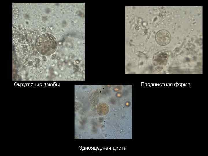 Округление амебы Предцистная форма Одноядерная циста 